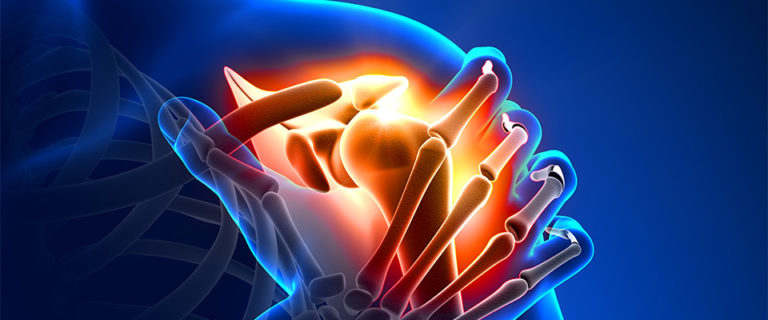 Delivering Joint Health Options