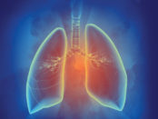 Inflammatory Lung Disease