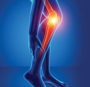 Bone Health and Natural Medicine