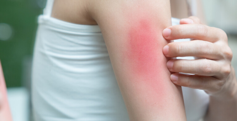 Lactobacillus acidophilus Postbiotic